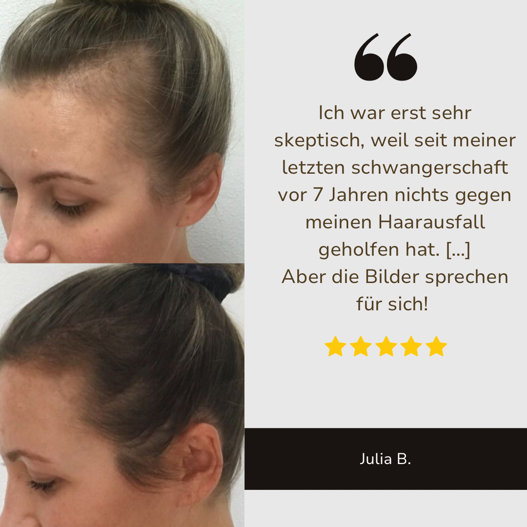 Ylvis Hair Grow Brush - Die Lösung gegen Haarausfall